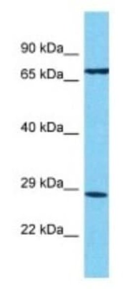 TAS2R13 Rabbit anti-Human, Polyclonal, Novus Biologicals:Antibodies:Primary